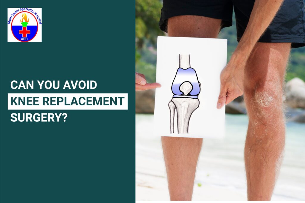 Can You Avoid Knee Replacement Surgery