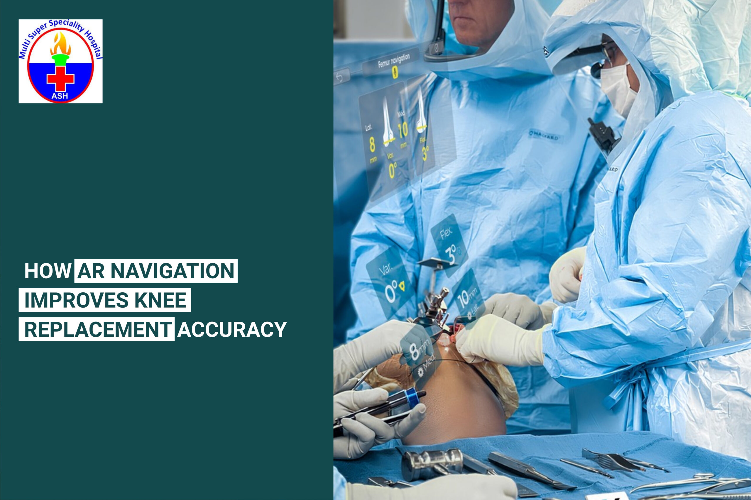 How AR Navigation Improves Knee Replacement Accuracy