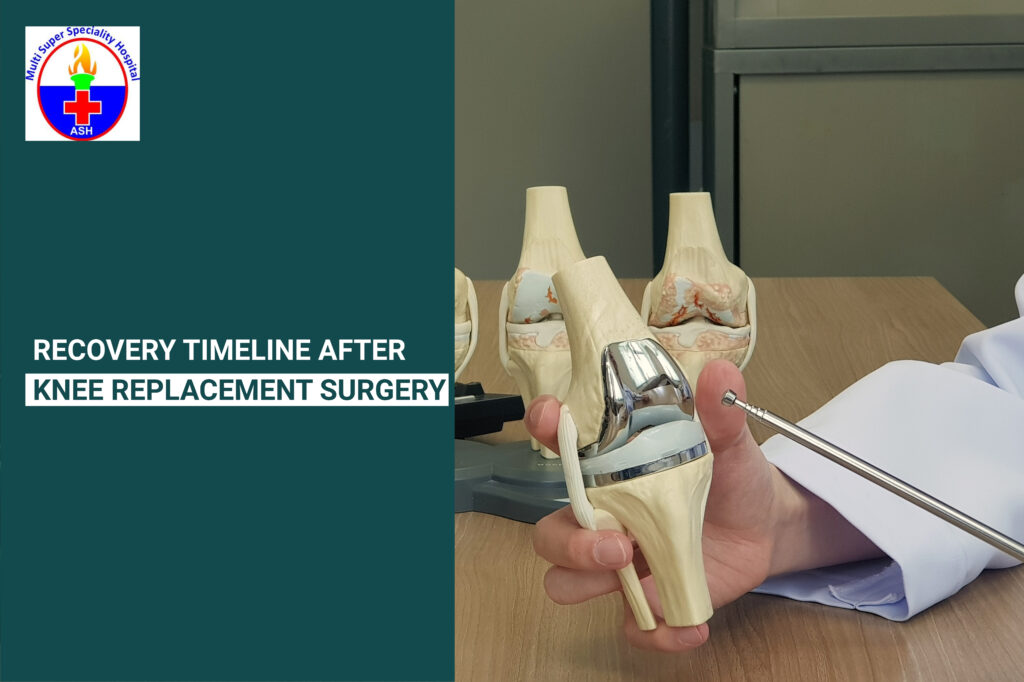 knee surgery recovery time