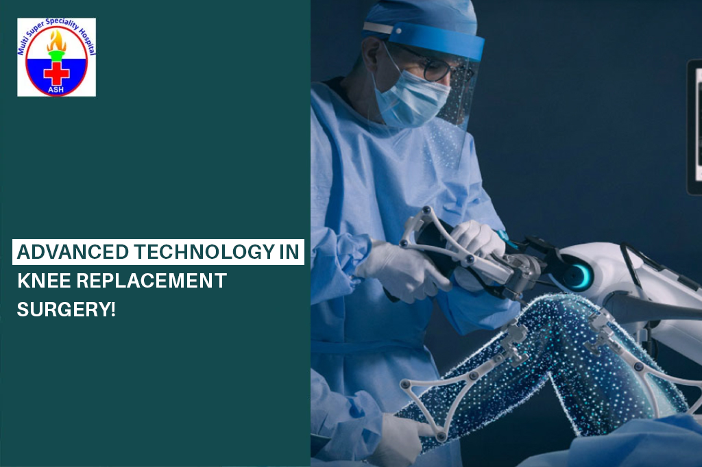 Advanced Technology in Knee Replacement Surgery