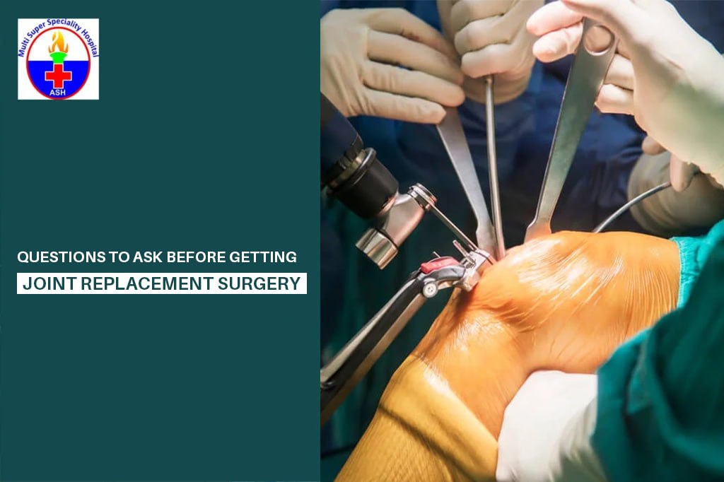 Questions to Ask Before Getting Joint Replacement Surgery