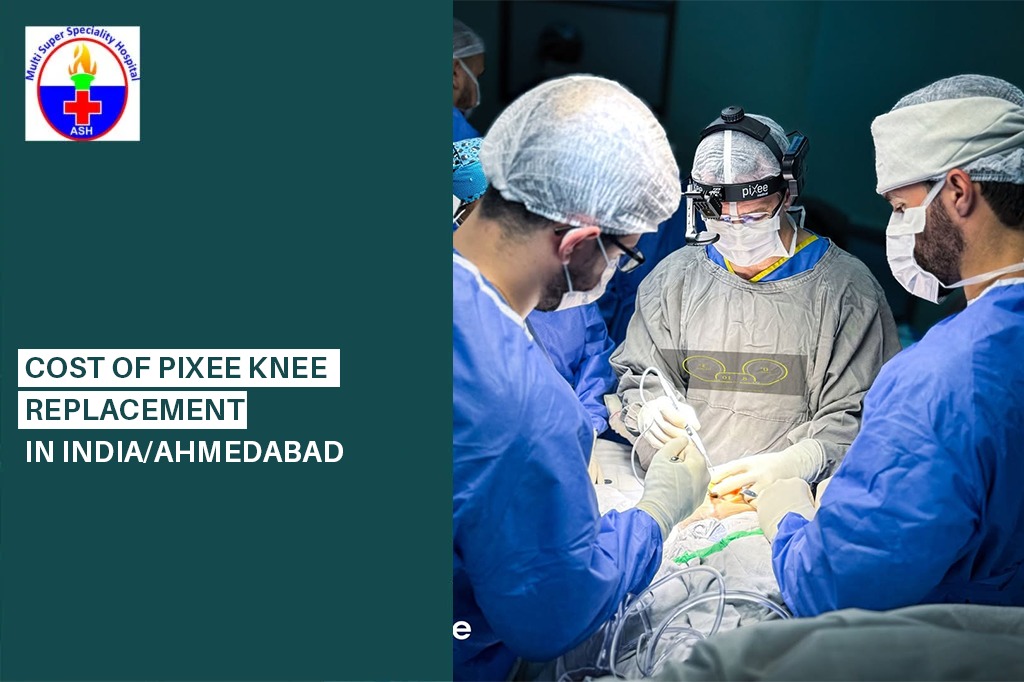 Pixee Knee Replacement in India