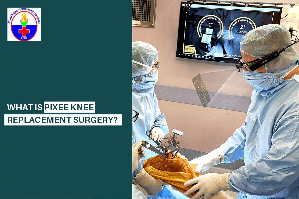 What Is Pixee Knee Replacement Surgery