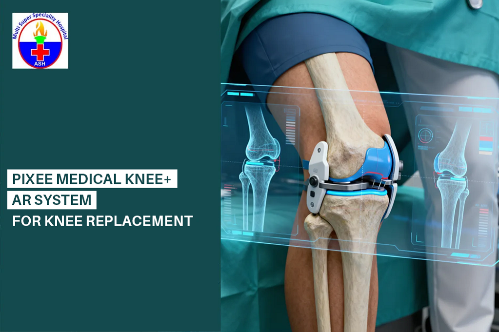 Pixee Medical Knee+ AR System for Knee Replacement