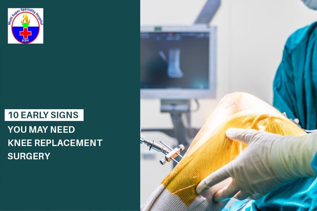 Knee Replacement Surgery