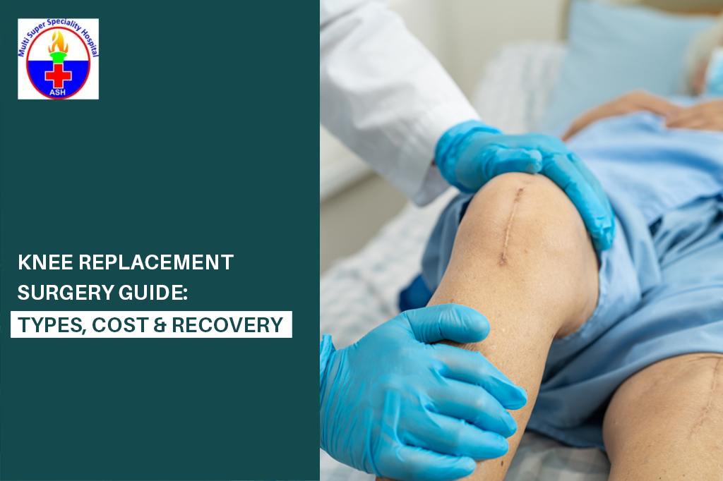 Knee Replacement Surgery