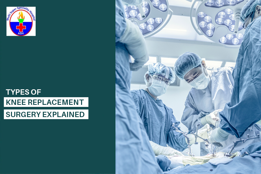 Knee Replacement Surgery Explained6